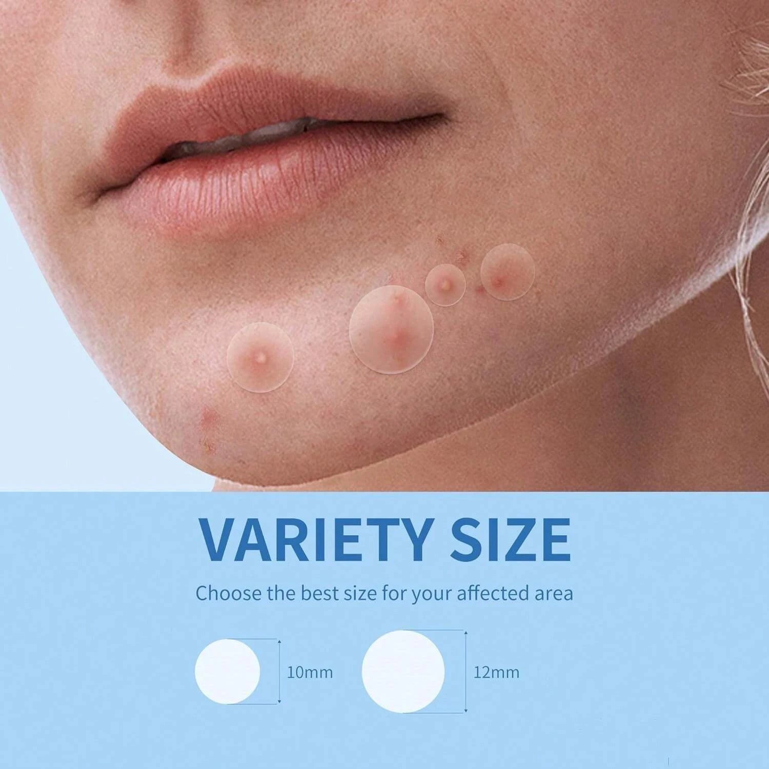 Pimple Patches | ORŸA