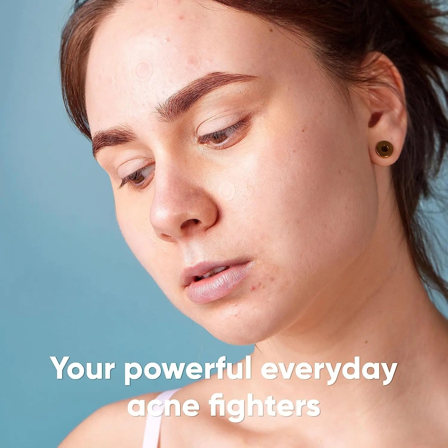 Pimple Patches | ORŸA